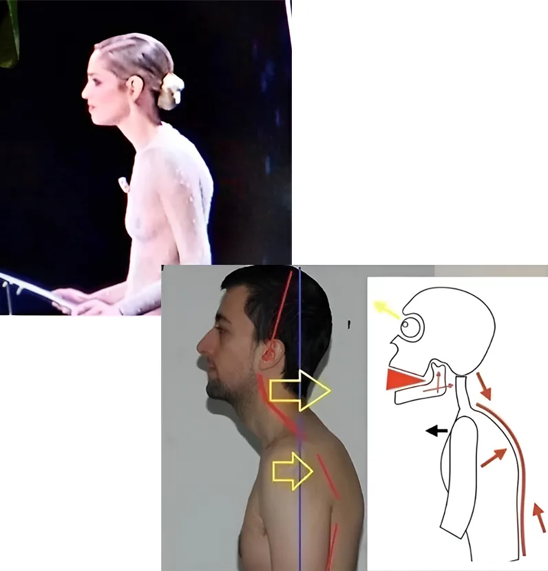 differenza tra posture